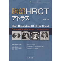 胸部ＨＲＣＴアトラス