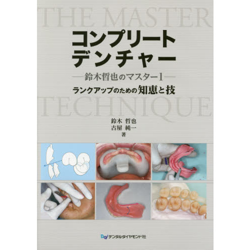 コンプリートデンチャー 鈴木哲也のマスター1 ランクアップのための知恵と技