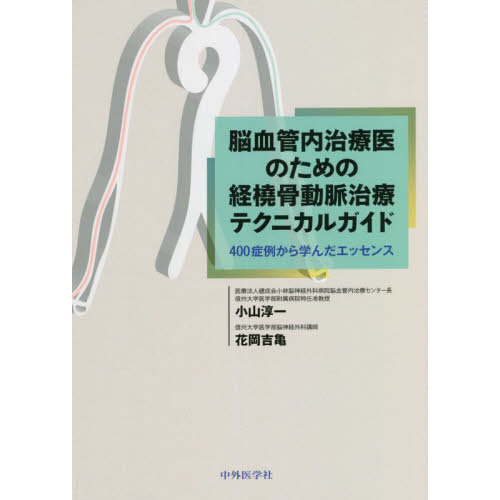 脳血管内治療医のための経橈骨動脈治療テクニカルガイド ４００症例