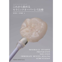 これから始めるセラミックオーバーレイ治療