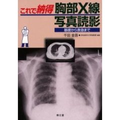 これで納得胸部Ｘ線写真読影　基礎から救急まで
