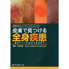皮膚で見つける全身疾患　頭のてっぺんからつま先まで