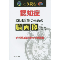 こう読む認知症原因診断のための脳画像　内科系と脳外科の診断流儀