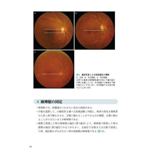 神経眼科診療のてびき　病歴と診察から導く鑑別疾患　第３版