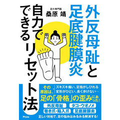 外反母趾と足底腱膜炎自力でできるリセット法