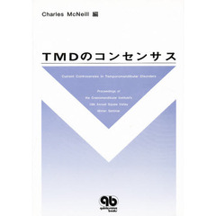 ＴＭＤのコンセンサス