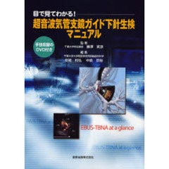 超音波気管支鏡ガイド下針生検マニュアル　目で見てわかる！