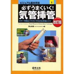 必ずうまくいく！気管挿管　カラー写真とイラストでわかる手技とコツ　改訂版