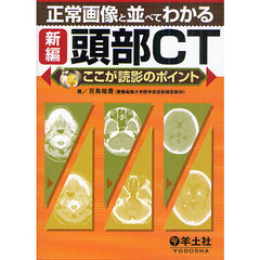 正常画像と並べてわかる新編頭部ＣＴ