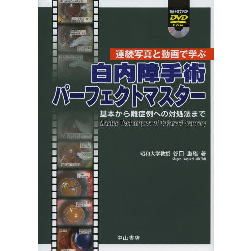 白内障手術パーフェクトマスター　基本から難症例への対処法まで　連続写真と動画で学ぶ