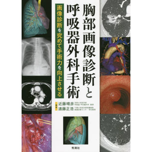 お得なセール情報 | 胸部画像診断と呼吸器外科手術 近藤晴彦