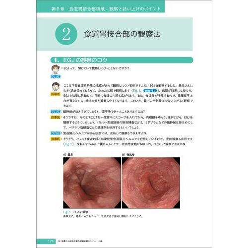 Ｄｒ．平澤の上部消化管内視鏡診断セミナー がんを見逃さないための