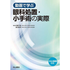 動画で学ぶ眼科処置・小手術の実際