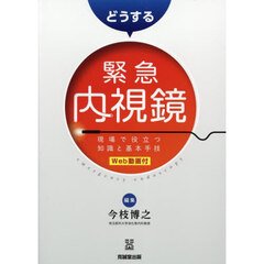 どうする緊急内視鏡　現場で役立つ知識と基本手技