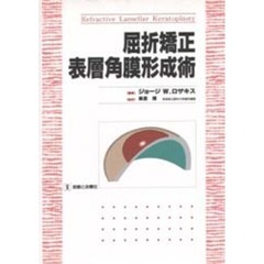 屈折矯正表層角膜形成術