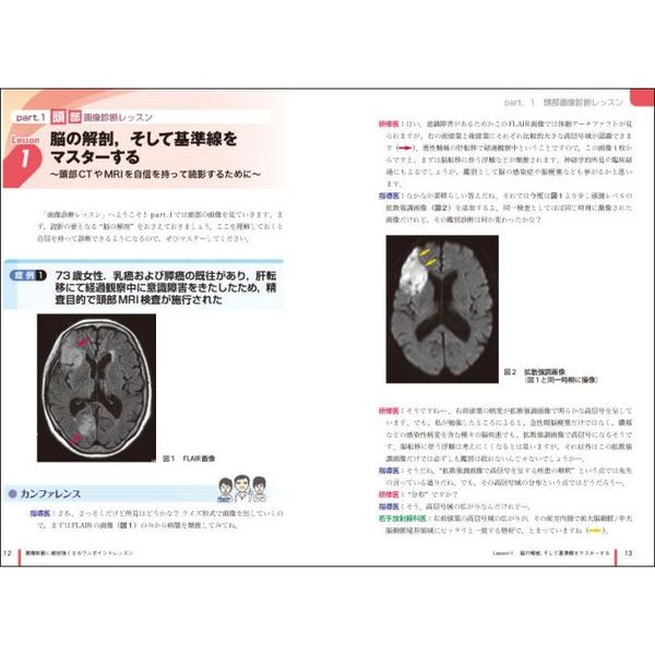 病態を見抜き、サインに気づく読影のコツ　画像診断に絶対強くなるワンポイントレッスン　通販｜セブンネットショッピング