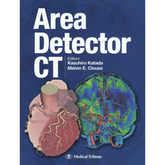 Ａｒｅａ　Ｄｅｔｅｃｔｏｒ　ＣＴ