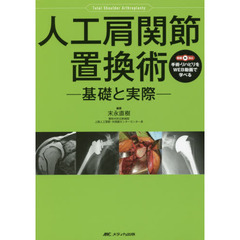 人工肩関節置換術　基礎と実際