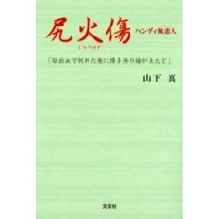 尻火傷　ハンディ風恋人　脳出血で倒れた俺に博多弁の嫁が来たど