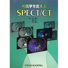 核医学を変えるＳＰＥＣＴ／ＣＴ