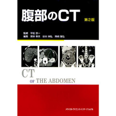 腹部のＣＴ　第２版