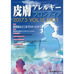 皮膚アレルギーフロンティア　Ｖｏｌ．１５Ｎｏ．１（２０１７．３）　特集「膠原病はどこまでわかったか？」