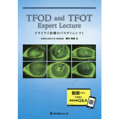 ＴＦＯＤ　ａｎｄ　ＴＦＯＴ　Ｅｘｐｅｒｔ　Ｌｅｃｔｕｒｅ　ドライアイ診療のパラダイムシフト