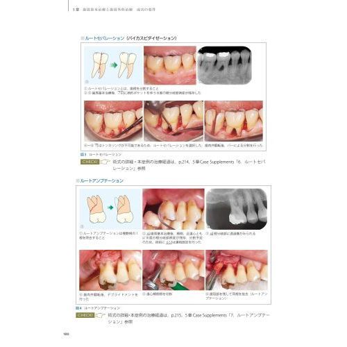 スカンジナビアンアプローチの実践　Ｄｒ．弘岡に訊く臨床的ペリオ講座