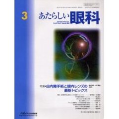あたらしい眼科　Ｖｏｌ．１９Ｎｏ．３（２００２Ｍａｒｃｈ）　特集・白内障手術と眼内レンズの最新トピックス