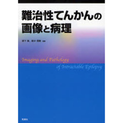 難治性てんかんの画像と病理