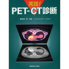 実践！ＰＥＴ－ＣＴ診断