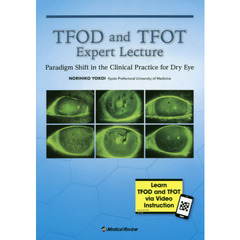 ＴＦＯＤ　ａｎｄ　ＴＦＯＴ　Ｅｘｐｅｒｔ　Ｌｅｃｔｕｒｅ　Ｐａｒａｄｉｇｍ　Ｓｈｉｆｔ　ｉｎ　ｔｈｅ　Ｃｌｉｎｉｃａｌ　Ｐｒａｃｔｉｃｅ　ｆｏｒ　Ｄｒｙ　Ｅｙｅ