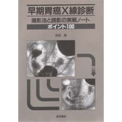 早期胃癌Ｘ線診断　撮影法と読影の実戦ノー