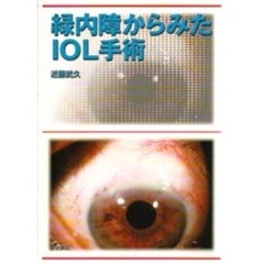 緑内障からみたＩＯＬ手術