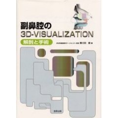 副鼻腔の３Ｄ－ＶＩＳＵＡＬＩＺＡＴＩＯＮ　解剖と手術