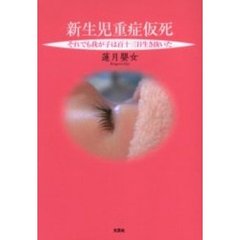 新生児重症仮死　それでも我が子は百十三日生き抜いた