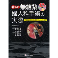 新しい無結紮婦人科手術の実際　子宮摘出術におけるＢｉＣｌａｍｐの応用