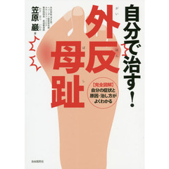 自分で治す！外反母趾　〈完全図解〉自分の症状と原因・治し方がよくわかる