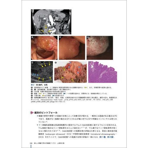 美しい画像で見る内視鏡アトラス上部消化管 腫瘍から感染性