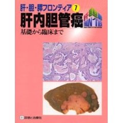 肝内胆管癌　基礎から臨床まで
