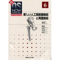 新しい人工関節置換術と再置換術