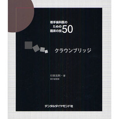 クラウンブリッジ