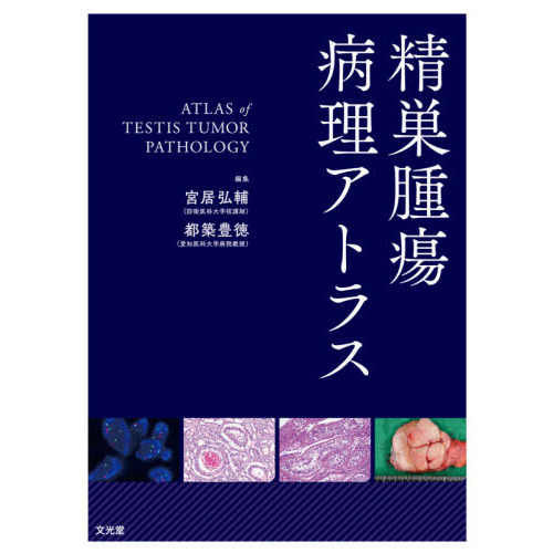 精巣腫瘍病理アトラス 裁断済み 精巣腫瘍病理アトラス 裁断済み