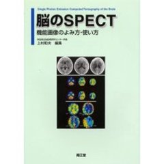 脳のＳＰＥＣＴ　機能画像のよみ方・使い方
