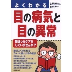 よくわかる目の病気と目の異常