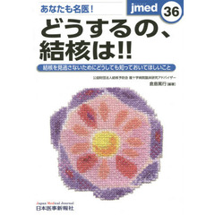 あなたも名医！どうするの、結核は！！　結核を見逃さないためにどうしても知っておいてほしいこと