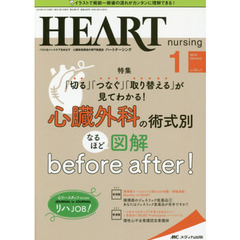 ハートナーシング　ベストなハートケアをめざす心臓疾患領域の専門看護誌　第３２巻１号（２０１９－１）　心臓外科の術式別なるほど図解ｂｅｆｏｒｅ　ａｆｔｅｒ！