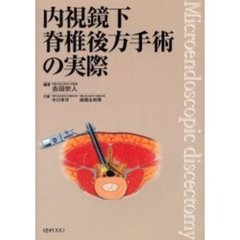 内視鏡下脊椎後方手術の実際