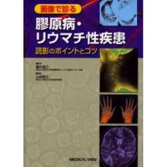 画像で診る膠原病・リウマチ性疾患　読影のポイントとコツ