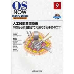 人工股関節置換術　ＭＩＳから再置換まで応用できる手技のコツ